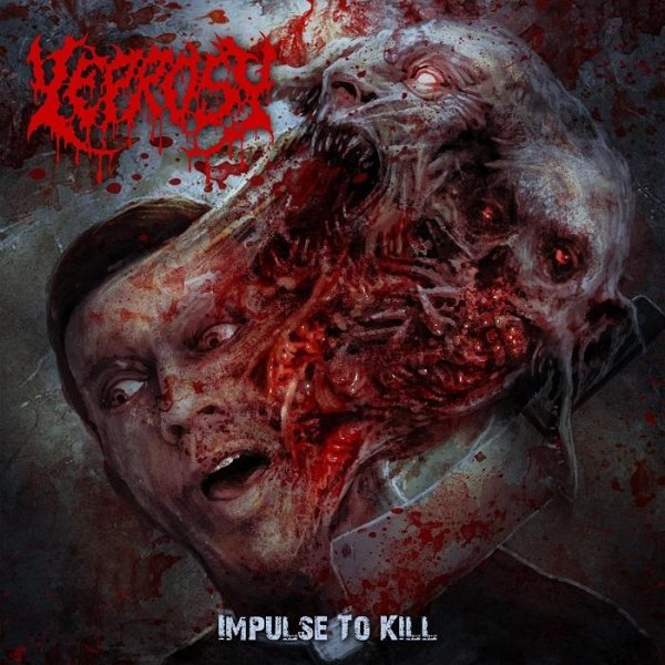 Leprosy - Walking Autopsy